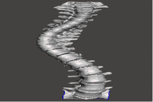 脊柱骨骼3D模型