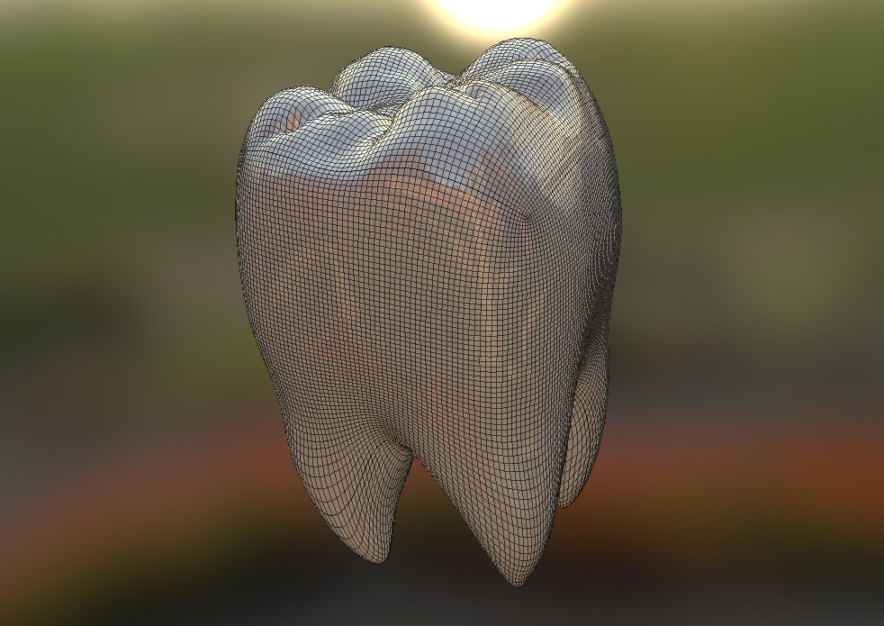 牙齿三维模型1