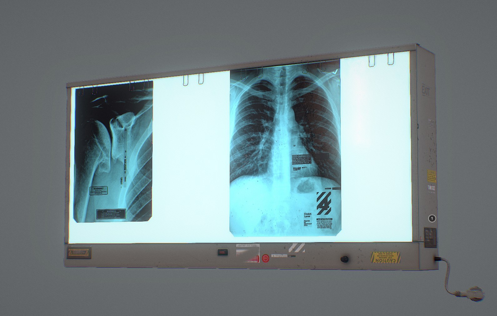 医学X射线图像查看器0